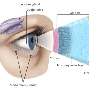 Dry-Eye-Disease