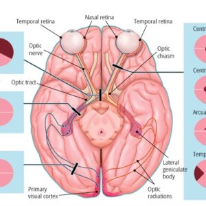 Visual Fields and Pathways